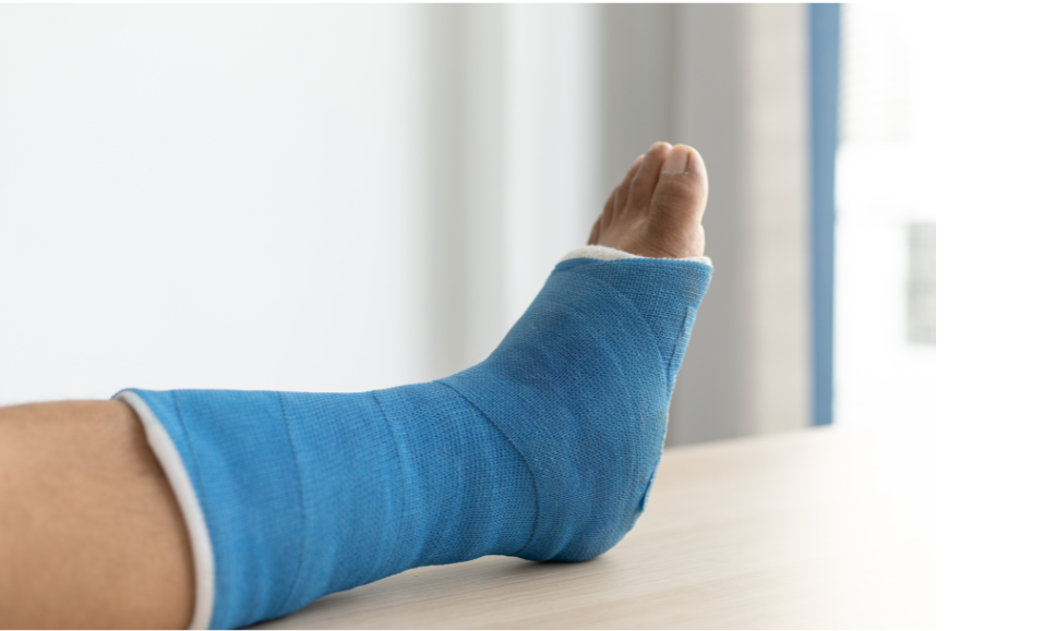 Leg injury