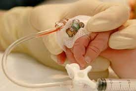 neonatal cannulation.jpg