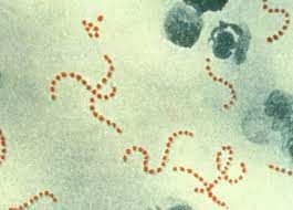 Streptococcus  A (Strep A)